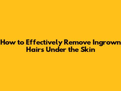 How to Effectively Remove Ingrown Hairs Under the Skin