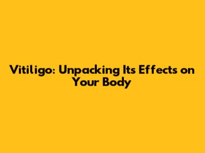 Vitiligo: Unpacking Its Effects on Your Body
